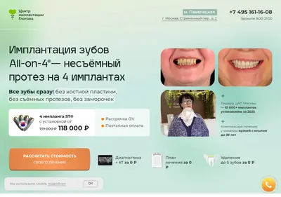 Снимок главной страницы 4implants-glotov.ru