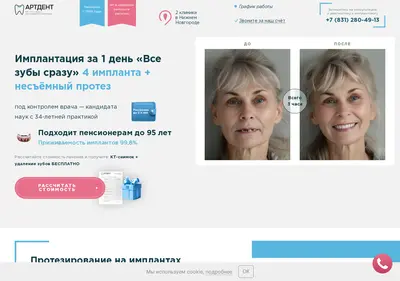 Снимок главной страницы allon4-artdent.ru