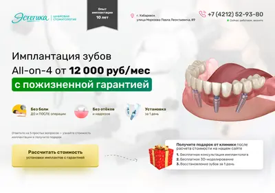 Снимок главной страницы allon4-implanty-stom.ru
